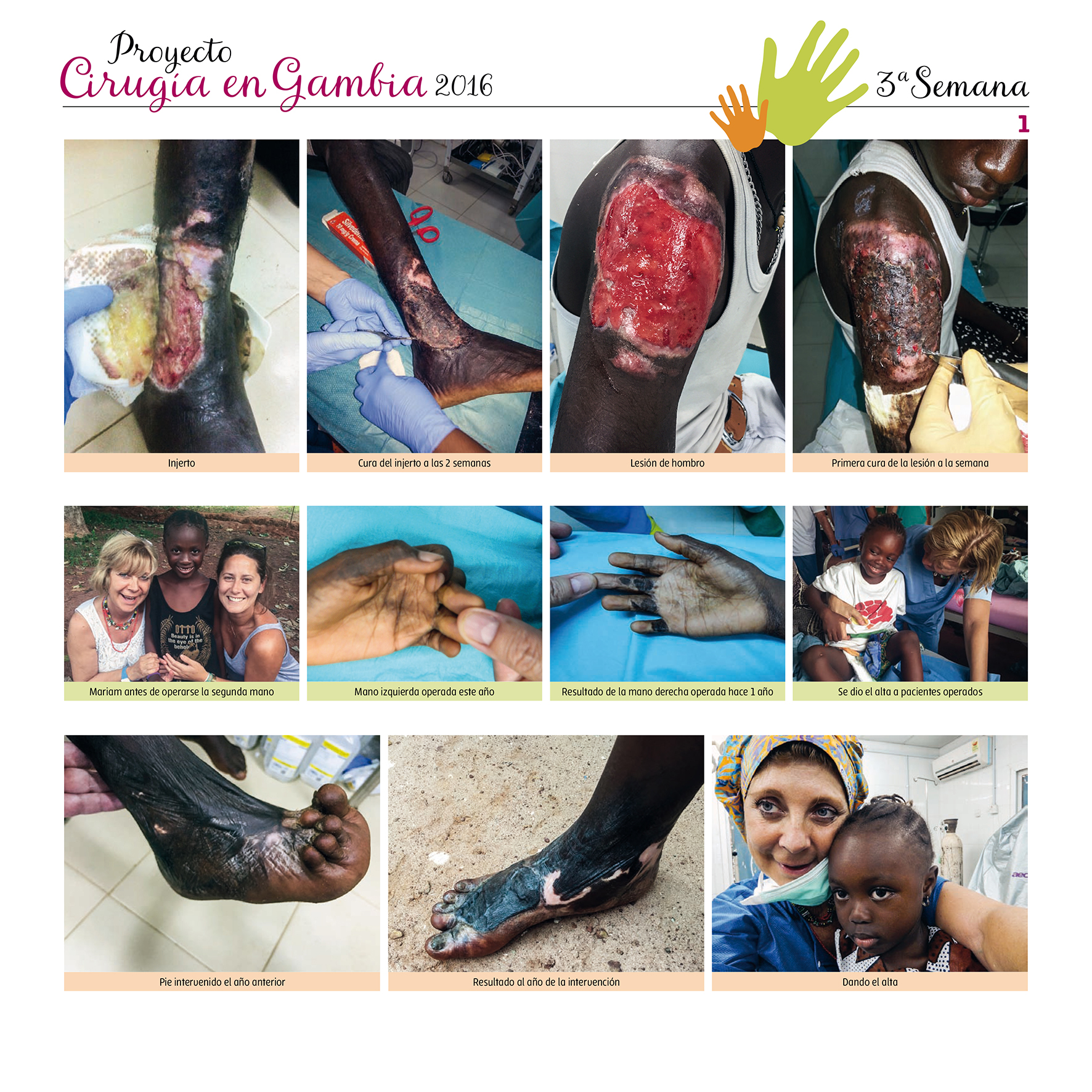 Cirurgia a Gambia 2016